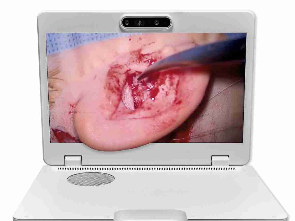 达擎之＂Heads-up 3D显微手术显示系统＂，，整合4K裸眼3D显示及眼球追踪系统，，，具备快速追踪人眼移动位置功能，，，，减轻医师长时间维持固定姿势的负担，，，，让医师能有更宽广清晰的3D立体视野及更舒适的姿势来执行手术。。。。